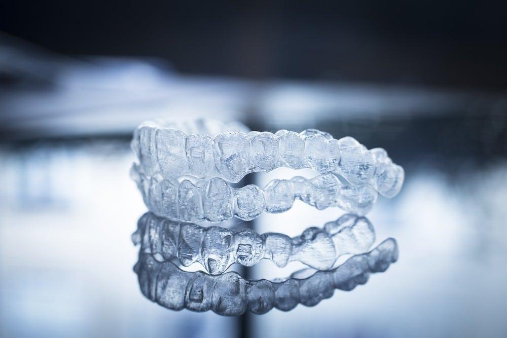 Getting Started with Instant Orthodontics