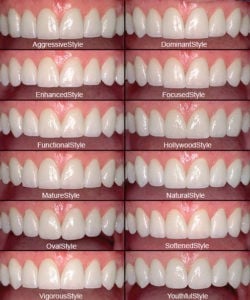 CEREC® Porcelain Crowns: Procedure, Types, Strength & Durability