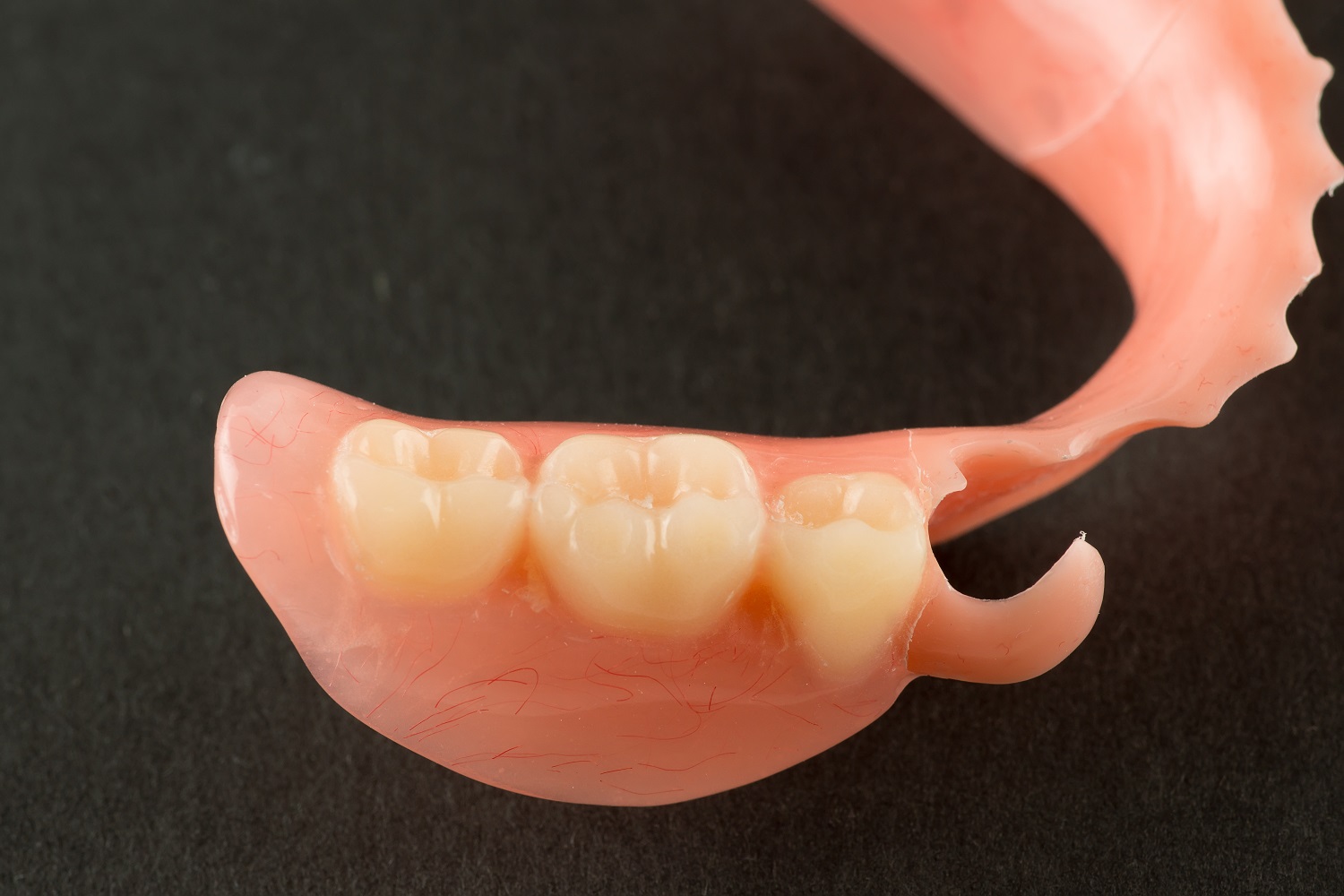 what-are-flexible-partial-dentures-sarasota-dentistry